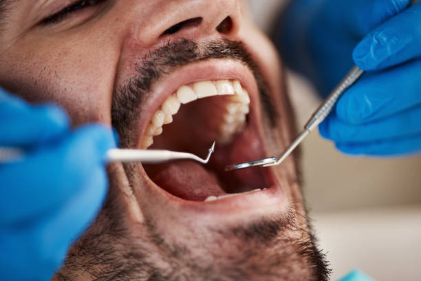 Best Pediatric Emergency Dentist in Newton, NC